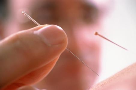 Acupuncturist